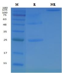 Recombinant Anti-Human CD28 mAb (Cat. No. C02302) SDS-PAGE under reducing (R) & Non-reducing conditions. The gel was stained with C02302 SDS-PAGE.