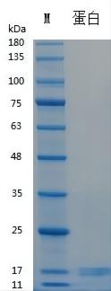 Recombinant Human Activin A (Cat. No. Y00101N) SDS-PAGE under reducing (R) & Non-reducing conditions. The gel was stained with Y00101N SDS-PAGE.