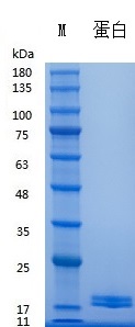 Recombinant Human FGF4 (Cat. No. Y00901) SDS-PAGE under reducing (R) & Non-reducing conditions. The gel was stained with Y00901 SDS-PAGE.