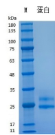 Recombinant Human FLT-3L (Cat. No. Y01201) SDS-PAGE under reducing (R) & Non-reducing conditions. The gel was stained with Y01201 SDS-PAGE.