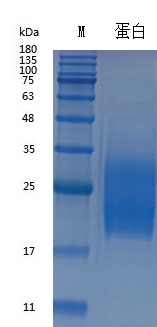 Recombinant Human GM-CSF (Cat. No. Y01501) SDS-PAGE under reducing (R) & Non-reducing conditions. The gel was stained with Y01501 SDS-PAGE.