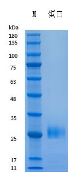 Recombinant Human IFNγ (Cat. No. Y01801) SDS-PAGE under reducing (R) & Non-reducing conditions. The gel was stained with Y01801 SDS-PAGE.