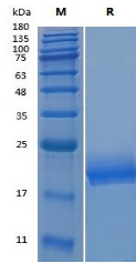 Recombinant Human IL-4 (Cat. No. Y02201) SDS-PAGE under reducing (R) condition. The gel was stained with Y02201 SDS-PAGE.