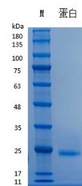 Recombinant Human IL-6 (Cat. No. Y02301) SDS-PAGE under reducing (R) & Non-reducing conditions. The gel was stained with Y02301 SDS-PAGE.
