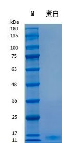 Recombinant Human IL-7 (Cat. No. Y02401) SDS-PAGE under reducing (R) & Non-reducing conditions. The gel was stained with Y02401 SDS-PAGE.