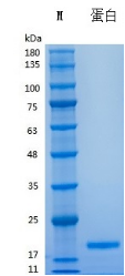 Recombinant Human IL-21 (Cat. No. Y02901) SDS-PAGE under reducing (R) & Non-reducing conditions. The gel was stained with Y02901 SDS-PAGE.