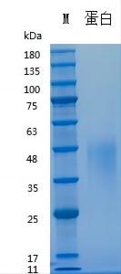 Recombinant Human LIF (Cat. No. Y03001) SDS-PAGE under reducing (R) & Non-reducing conditions. The gel was stained with Y03001 SDS-PAGE.