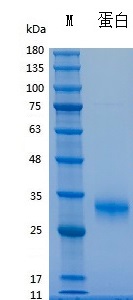 Recombinant Human Noggin (Cat. No. Y03301) SDS-PAGE under reducing (R) & Non-reducing conditions. The gel was stained with Y03301 SDS-PAGE.