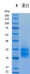 Recombinant Human SCF (Cat. No. Y03801) SDS-PAGE under reducing (R) & Non-reducing conditions. The gel was stained with Y03801 SDS-PAGE.